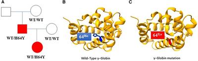 Case Report: A case report and literature review of hemoglobin variation associated with neonatal cyanosis